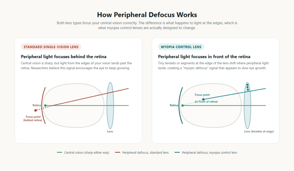 Pair of glasses used to illustrate how myopia control lenses work